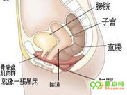 膀胱脱垂