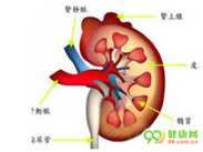 常染色体显性多囊肾